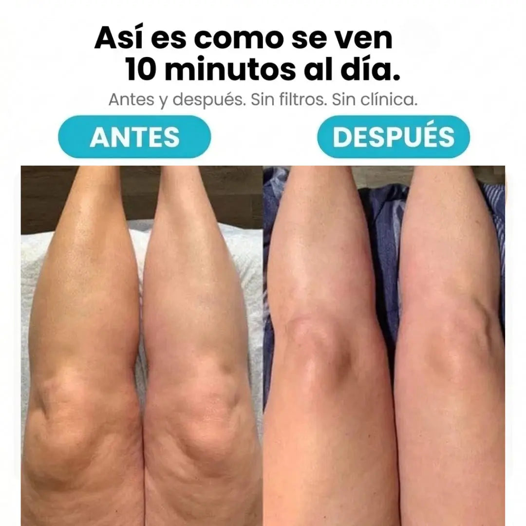 Masajeador Rotatorio Anti-Cellulite