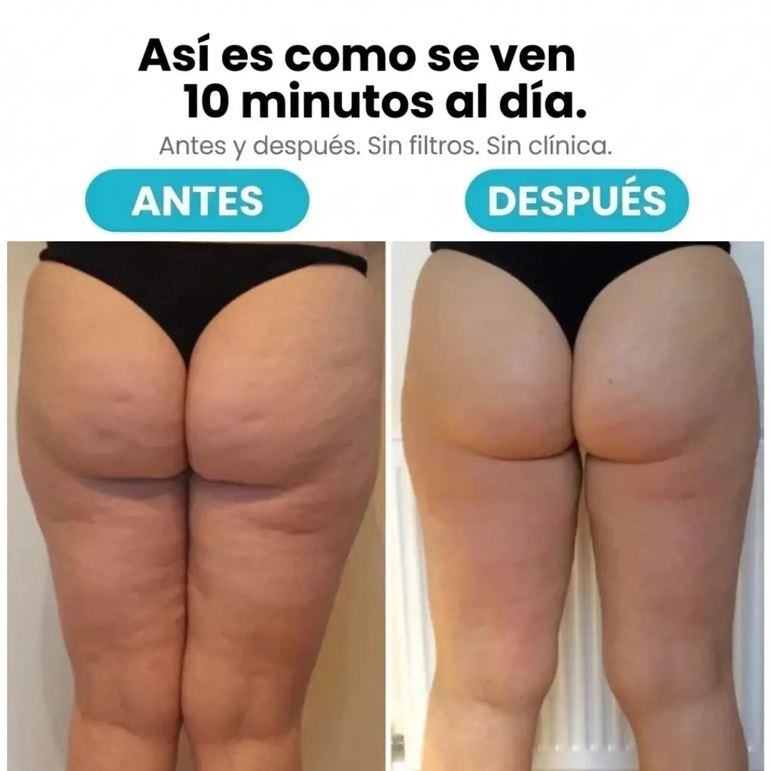 TONIQ™ - Masajeador Rotatorio Anti-Cellulite